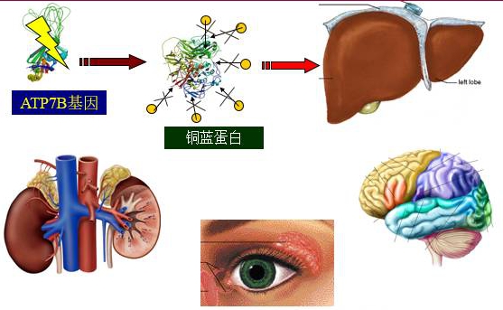 3岁宝宝转氨酶高，查基因原来是“铜娃娃”
