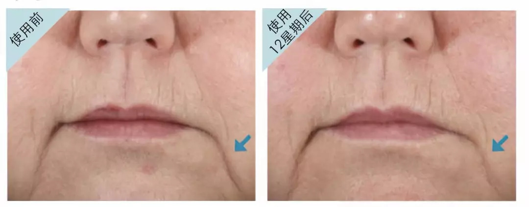 测评护肤品专业,测评最好的护肤套装