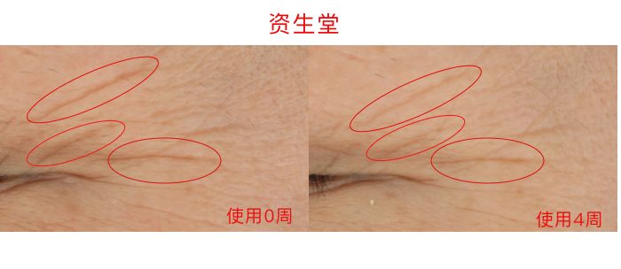 眼霜推荐lamer浓缩眼霜,lamer浓缩眼霜黑眼圈评测