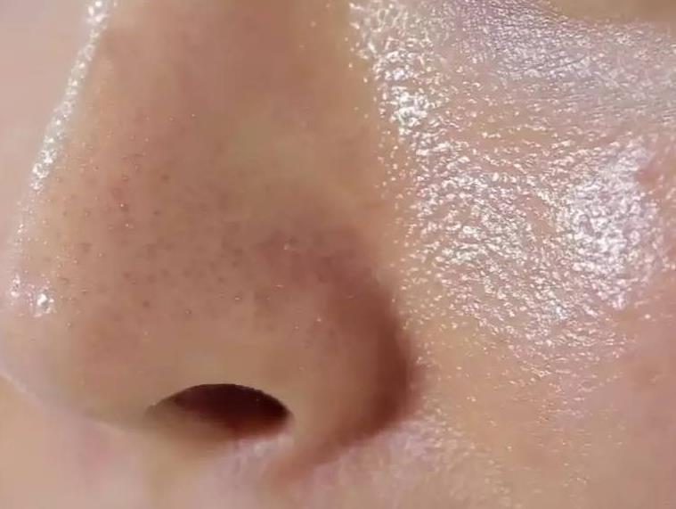 脸上有螨虫怎么彻底消灭,脸上有螨虫怎么消灭螨虫