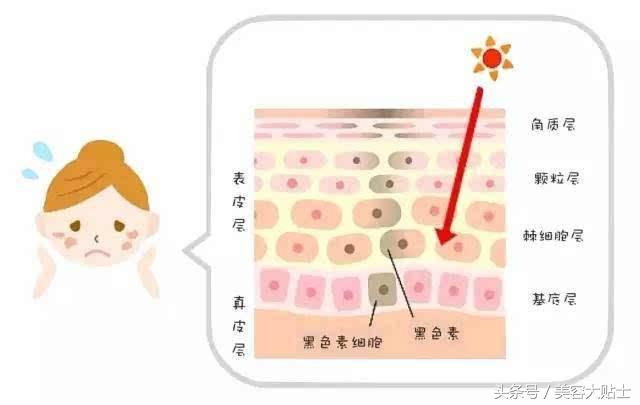 去海南晒伤晒斑怎么办,去了一次海边满脸晒斑怎么办