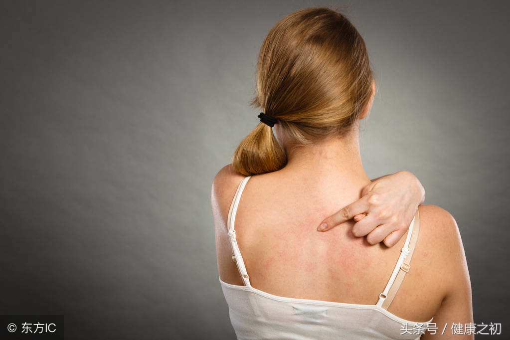 还在信偏方？*麻疹荨**到底怎么治疗更有效