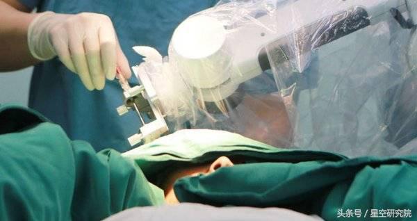 神经外科手术机器人视频,神经外科手术机器人核心技术
