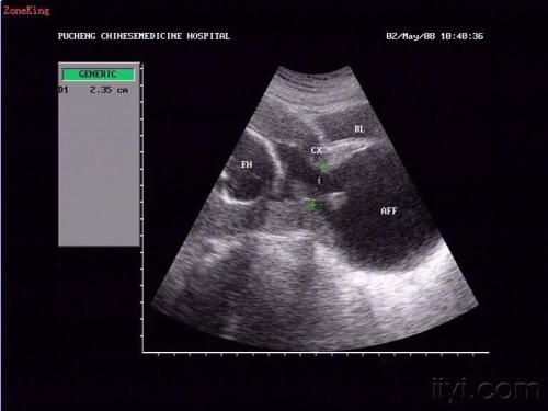 深夜产房：妻子隐瞒三次流产，丈夫装不知，夫妻都求助产士一件事