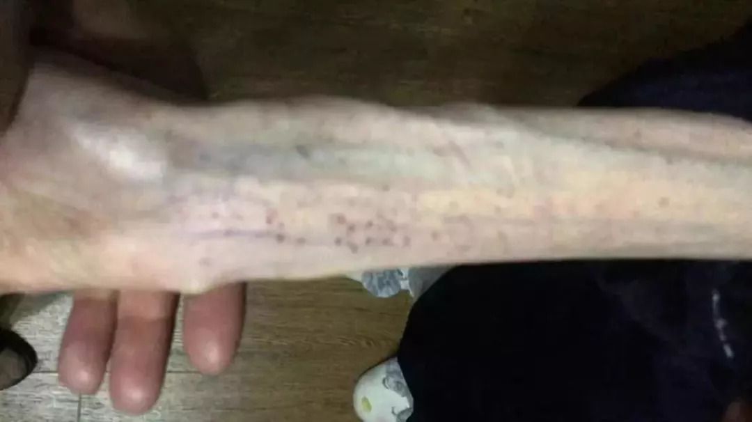 当代女性的减肥现状,减肥把身体减坏了