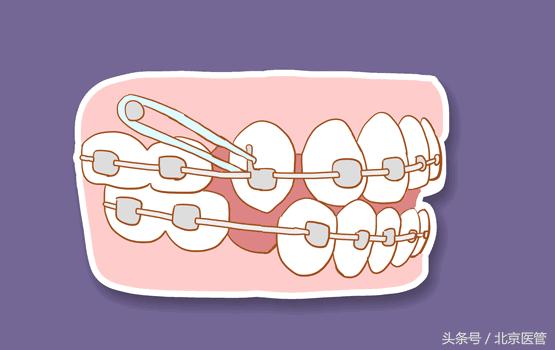 想变美但又怕手术,想变美又怕疼怎么办