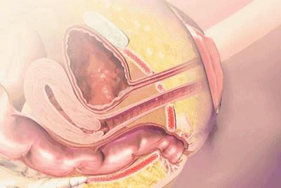 产后哪都瘦了，唯独这里不瘦