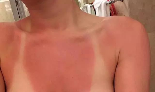 再来一波抗衰科普,你是不是对面部抗衰有什么误解