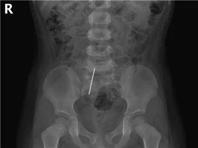 一些让人毛骨悚然拍到的照片,六个令人毛骨悚然的影像