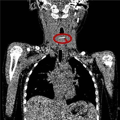 一些让人毛骨悚然拍到的照片,六个令人毛骨悚然的影像