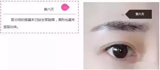 纹眉后一周眉毛变化过程,纹眉后1到七天的变化图
