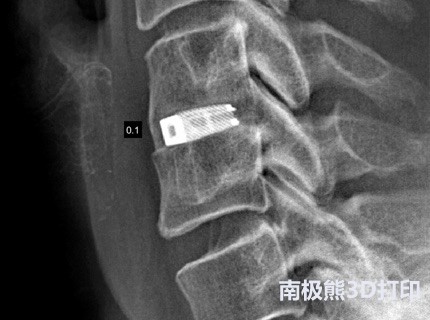 骨科植入物工厂,骨科植入物医疗器械公司