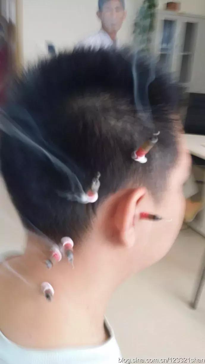 儿童近视7种早期症状,儿童近视的4大早期表现