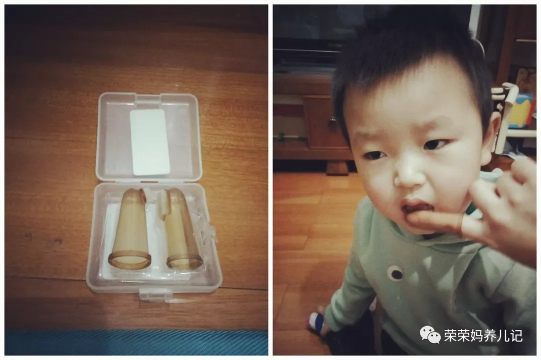 乳牙蛀牙可以不管它吗,孩子乳牙没换就蛀牙了需要补吗