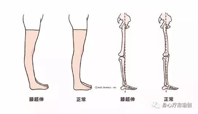 小腿胀瑜伽体式咋缓解,瑜伽小腿拉筋的正确方法视频