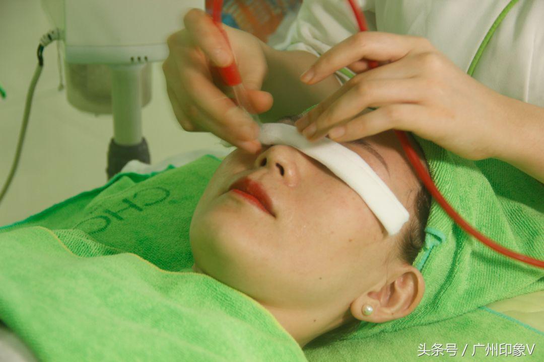 祛痘只需9元,现在很多9元祛痘靠谱吗