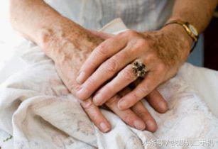 为什么人手上有青筋爆出来,50岁女人手上青筋暴起怎么回事