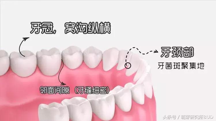 儿童牙齿严重龋齿补救方法,乳牙龋齿怎么治疗最好的方法
