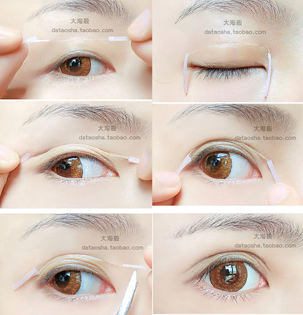 眼睛天生小怎么变大手术,眼睛天生小怎么办