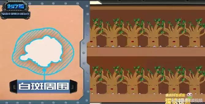 激光治疗和皮肤移植哪家强？治疗白癜风，最新黑科技大盘点