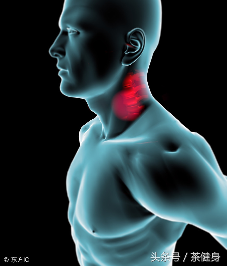 经常偏头痛练几个月健身就好,经常锻炼可以减轻偏头痛吗