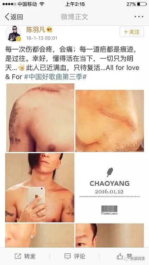 张雨绮持刀家暴丈夫次日即离婚,张雨绮拿刀砍前夫事件判了几年