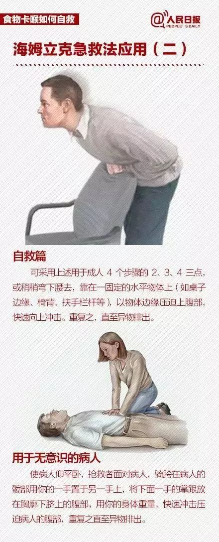 孩子被异物卡喉被救活的几率多大,孩子异物卡喉咙海姆立克急救法