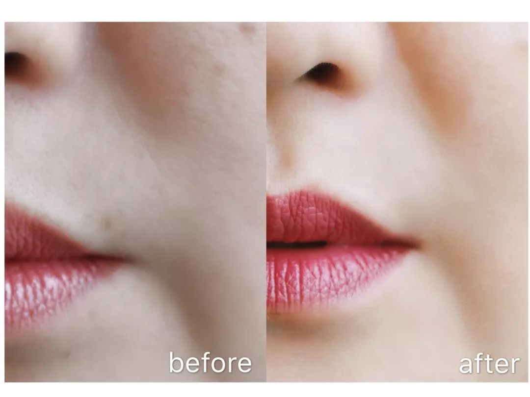 护肤领域有哪些科技成果,樊文花护肤都有什么项目