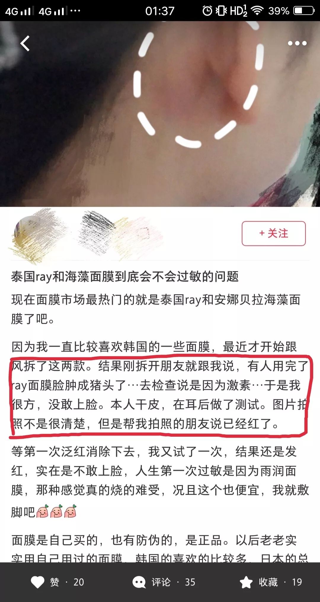 泰国面膜骗局揭秘,泰国ray面膜被爆含激素