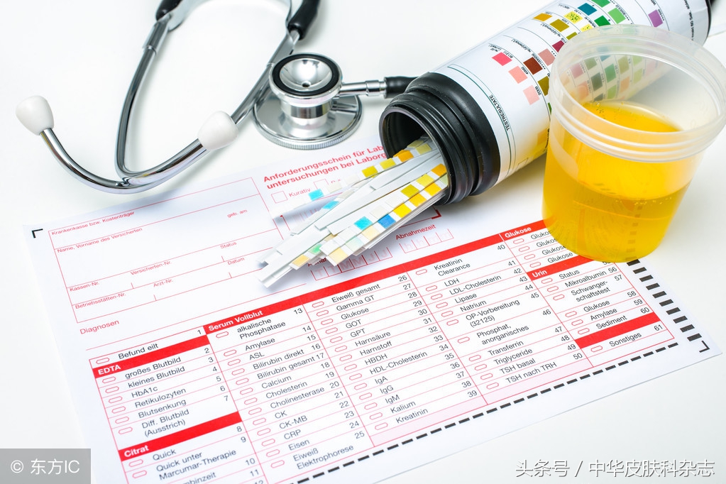 关于性病，你必须知道这些