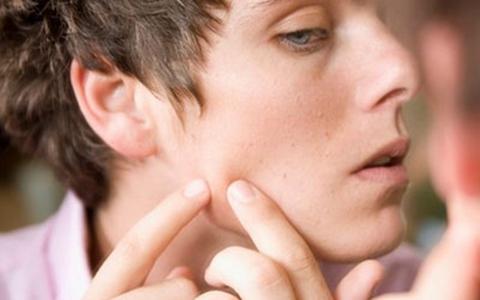 长痘后的痘印怎么办,长痘后留下痘印怎么去除