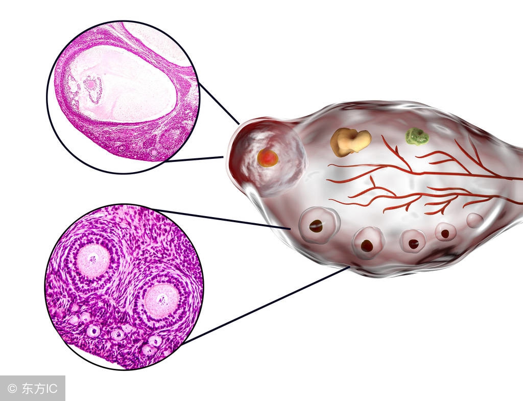 节育环下移了会有哪些症状出现,节育环下移是什么原因引起的