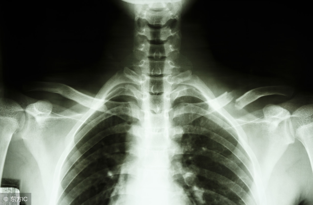 小孩骨折警惕四种表现,小孩骨折需要注意哪些