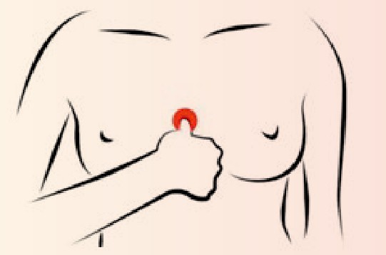 乳腺增生中药治疗法,乳腺结节增生中药可以治愈吗