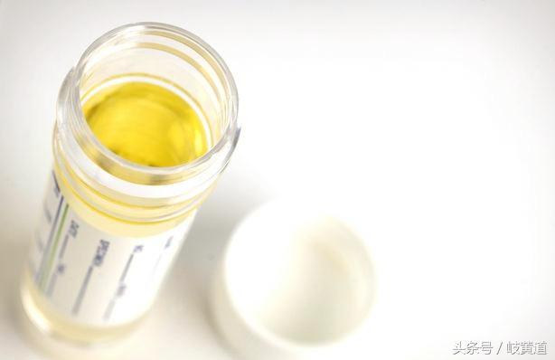 女性尿频尿急输液不见好,尿频尿急排尿困难吃药效果不佳