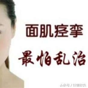 针灸治疗面肌痉挛,董氏针灸治面肌痉挛放血疗法