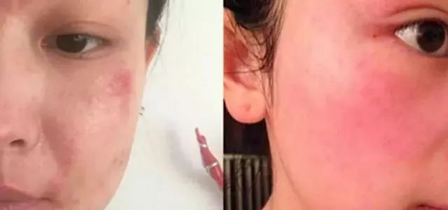 泰国美白大米手工皂,泰国米皂美白