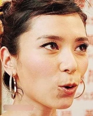 假期晒黑了怎么快速变白？试试刘雯、张馨予、林允的皮肤急救方案