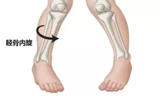 宝宝走路姿势异常晚上会严重吗,宝宝走路姿势异常图解