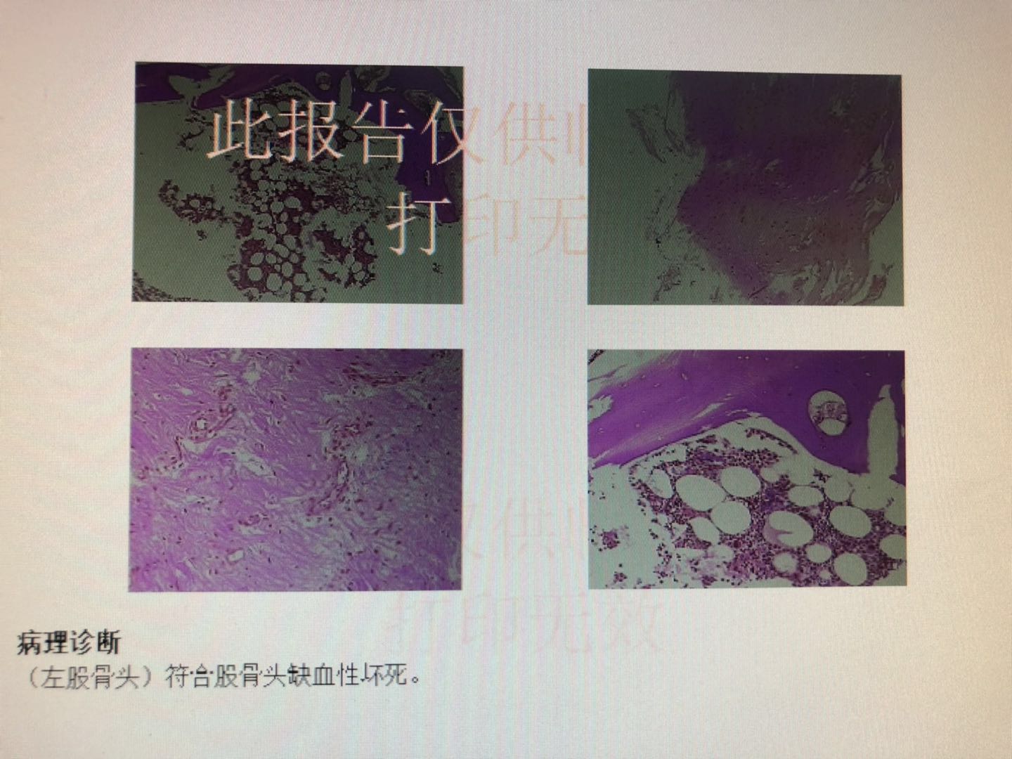 什么病做手术存活下来的几率低,什么病需要过一段时间才做手术