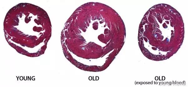 到底是不是智商税用了就知道,究竟是智商税还是真香