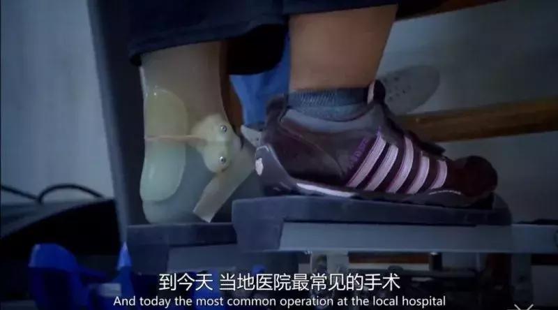 bbc全球最不健康的饮食,bbc纪录片关于健康饮食