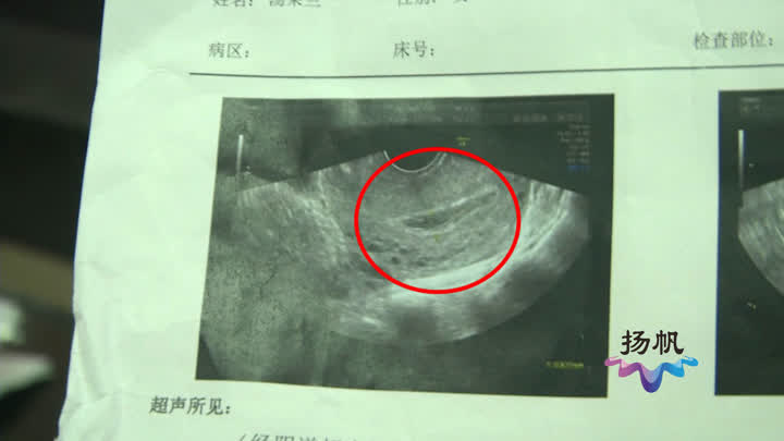 刚上的节育环为什么会移位,刚刚上节育环有什么反应