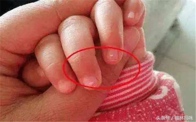 7岁小孩缺锌的症状有哪些表现,如何才能知道孩子是否缺锌