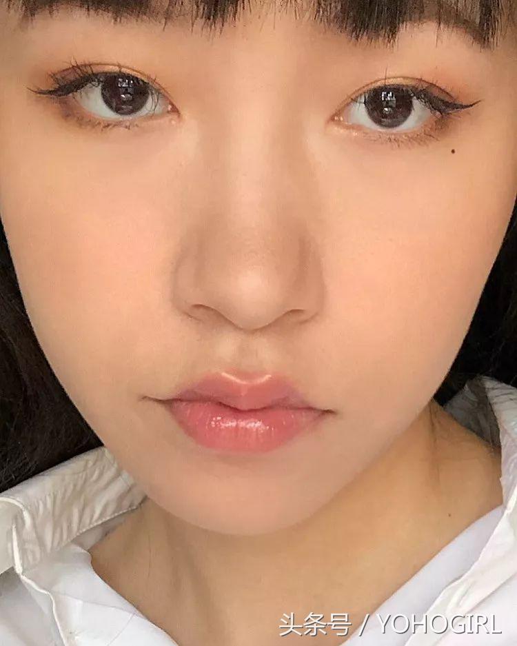 点痣的十大忠告,自己点痣的十大忠告