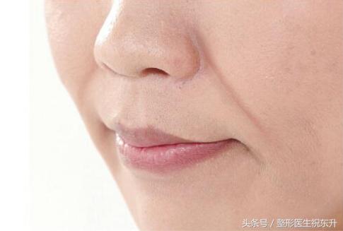 25岁脸皮肤松弛该怎么改善,脸皮肤松垮怎么补救