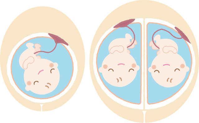 胎盘粘连常见护理诊断,宫腔粘连术后怀孕的会胎盘粘连吗