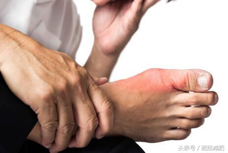 老人痛风吃什么食物最好降尿酸,痛风吃什么食物最好降尿酸