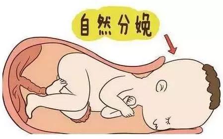 该顺还是该剖？知道这些或许医患矛盾会少一些……