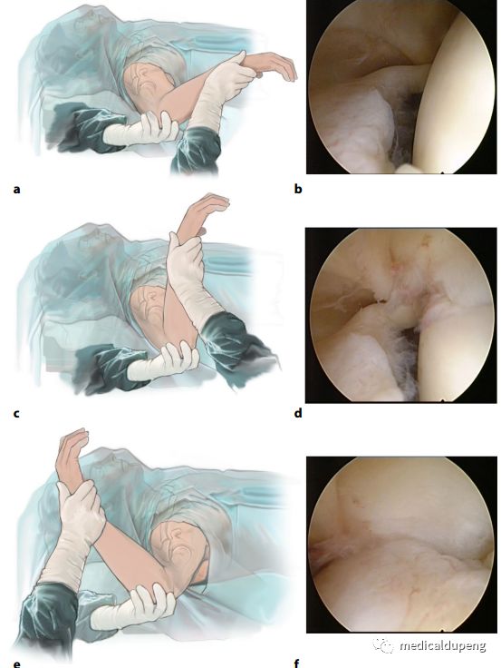 医学插画插图,医学插画sci
